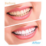 Набор для отбеливания зубов Luma Smile